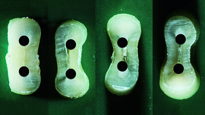 Dentinal defects after root canal preparation
