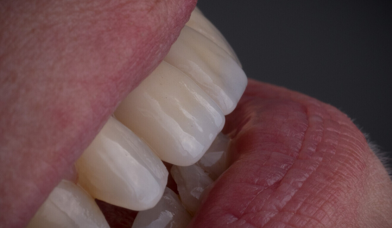 Fig. 12: Great optical integration. (Image: Emmanuel Charleux)