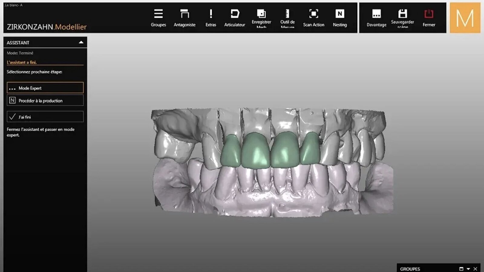 En busca de la sonrisa perdida (2)