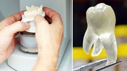 Nieuw 3D-printmateriaal maakt antimicrobiële neptand mogelijk