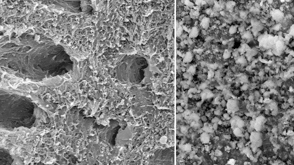 Ново биоактивно стъкло може да спре разграждането на деминерализирания дентин