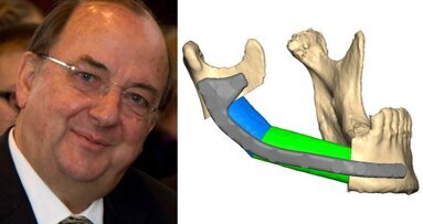 Интервю: Алтернативи на лицевите трансплантации в оралната и лицево-челюстната хирургия