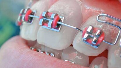 Smile for a Lifetime partners with America’s ToothFairy Smile for a Lifetime partners with America’s ToothFairy