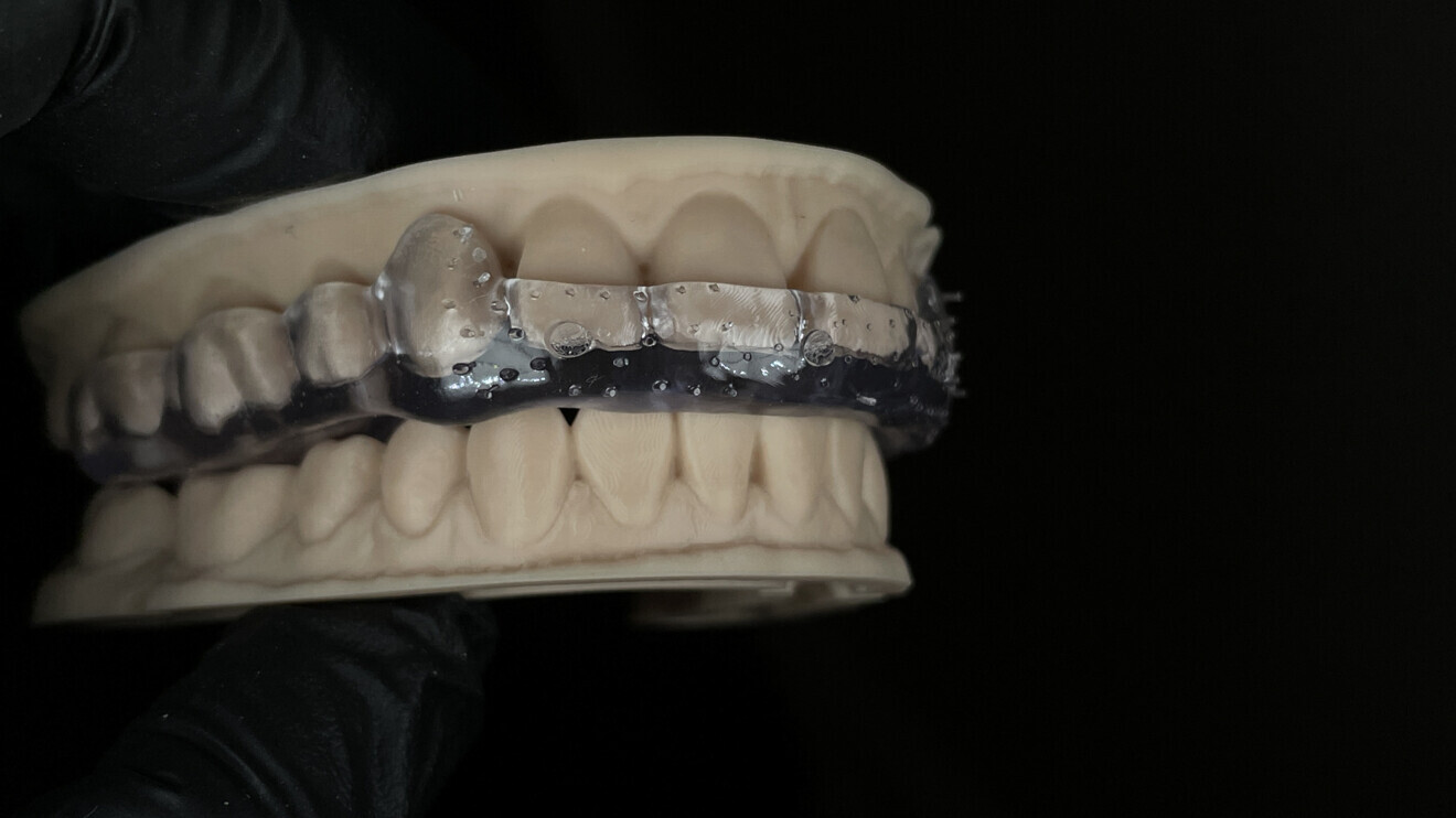 Fig. 9b: Splint on the model.