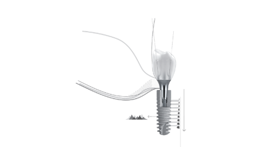 Dentsply Sirona – ANKYLOS