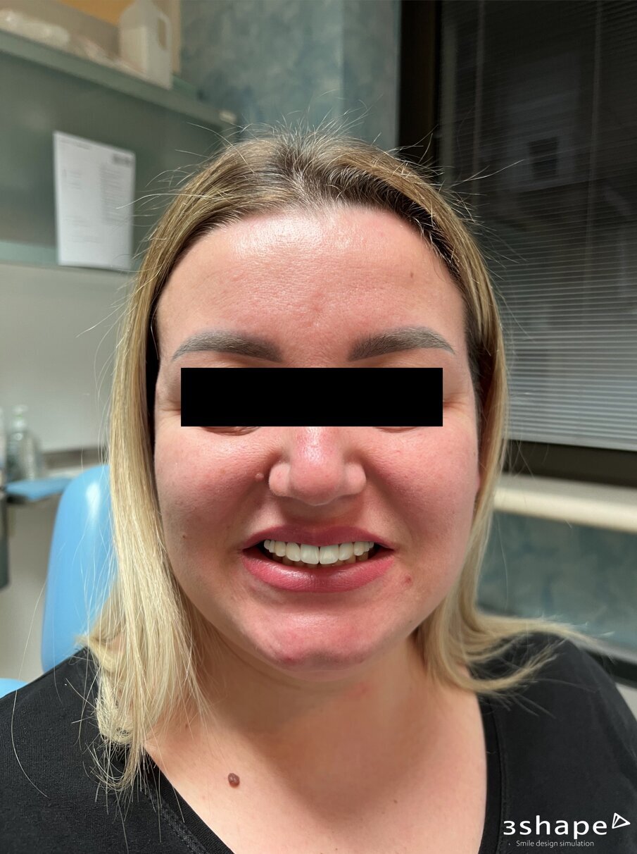 Fig. 14 - Il prototipo in visualizzazione immediata.