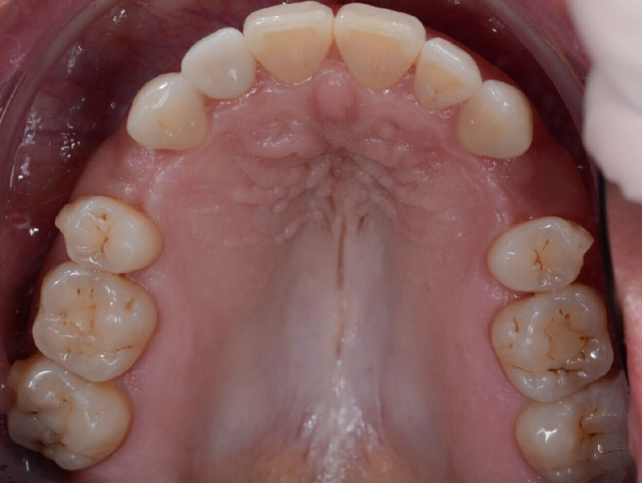 Fig. 5a: After an 18-month treatment to open space, driven this time by design, ...