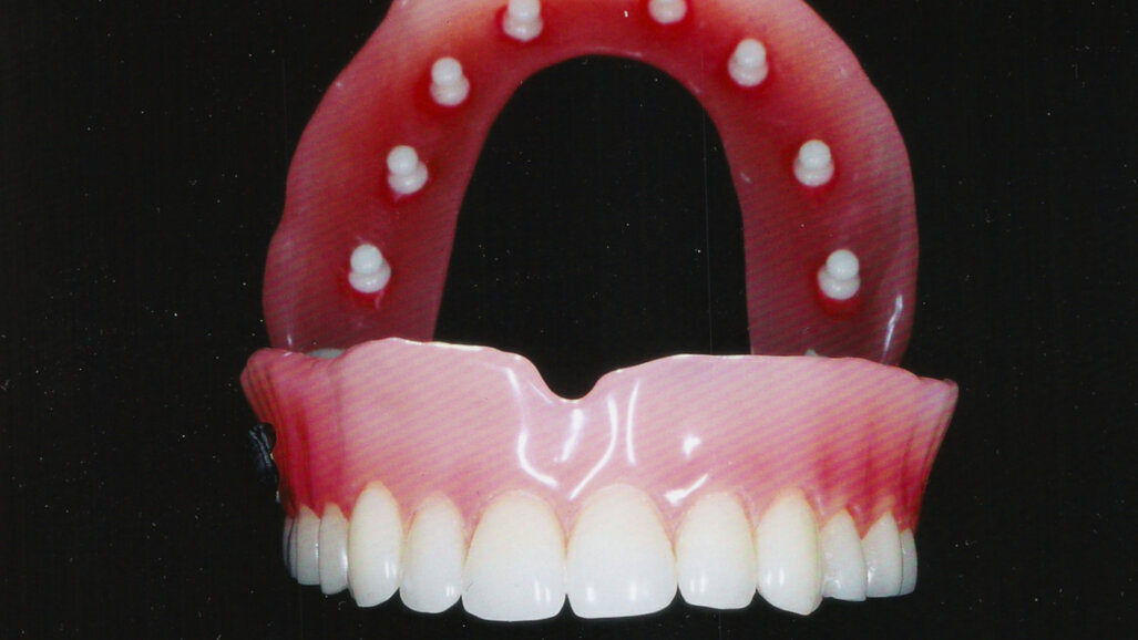 Proteze budućnosti...