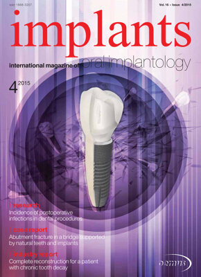 implants international No. 4, 2015 implants international No. 4, 2015