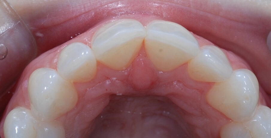 Fig. 20: Post treatment occlusal