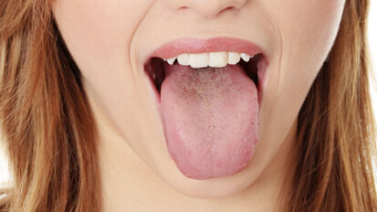 Trained nose can detect oral disease on bad breath