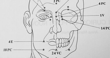 Lesione parziale del NAI: trattamento coadiuvante di un caso con agopuntura