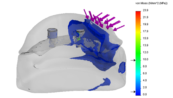 Numeryczna weryfikacja problematyki mocowania protezy całkowitej dolnej wspartej o 1 lub 2 wszczepy