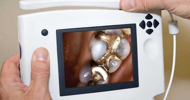 Crisp, clear intraoral images delivered on a screen your patients hold in their hands