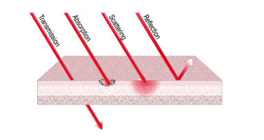 Laser in endodontics (Part I)