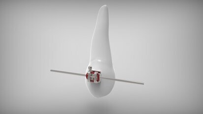 W Polsce rośnie popularność leczenia ortodontycznego