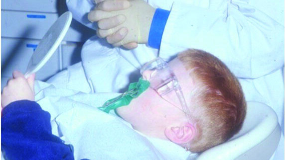 The Hall Technique: The novel method in restoring the carious primary molar