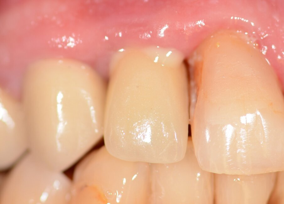 Fig. 1: Initial situation.