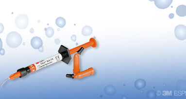 Αποκαταστάσεις ρητίνης τύπου bulk fill