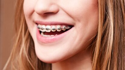 Orthodontische behandeling leidt niet tot meer zelfvertrouwen