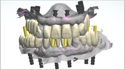 The fully digital Pro Arch protocol