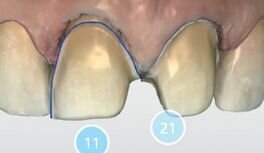 Afbeelding 8: Na de preparatie werd een tweede scan gemaakt.
