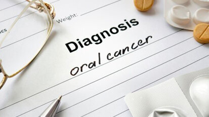 Grazie alla visualizzazione a fluorescenza la recidiva del cancro orale potrebbe diminuire