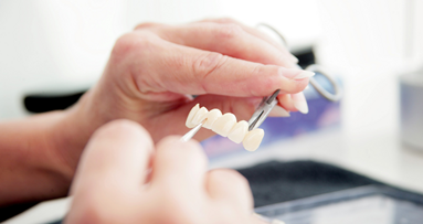 Einigung bei den Preisverhandlungen für Zahntechnik