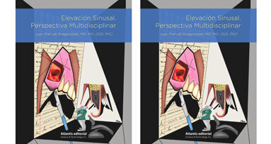 Guía práctica de una técnica de implantología
