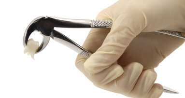 Kiezen of delen voor voetballers