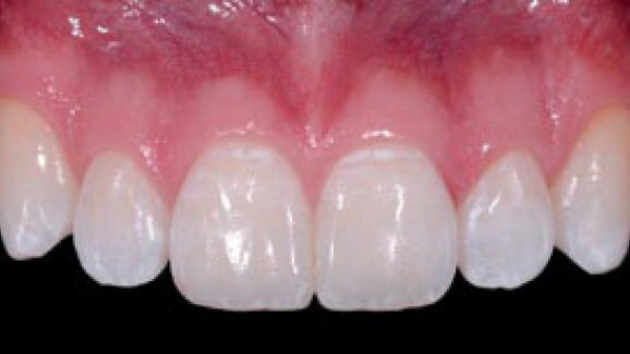 El color y la forma: objetivos de la estética