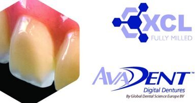 ‘s Werelds eerste digitale prothese