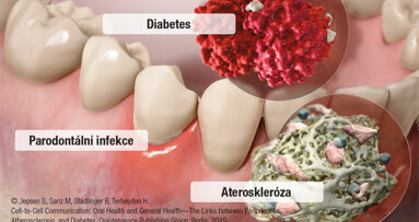 Holistické spojení mezi orálním a celkovým zdravím