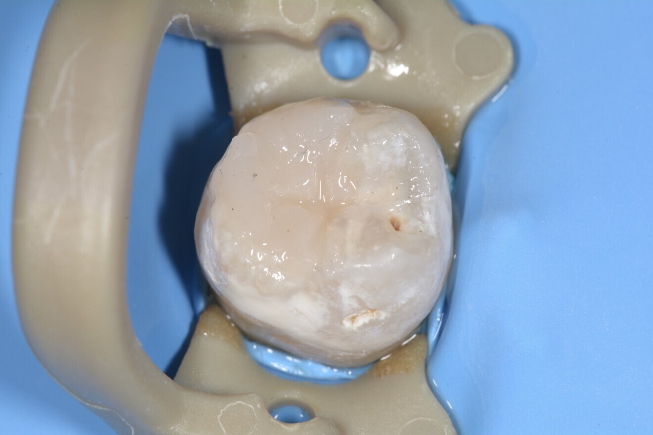 Fig. 16 : Reconstitution terminée.