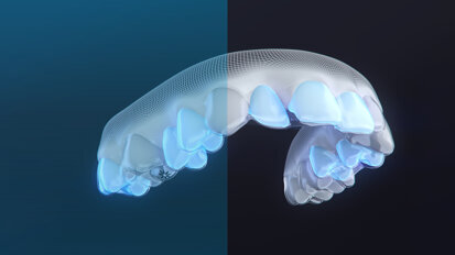 Align Technology predstavlja paket Invisalign Moderate, zdravljenje za korekcijo blage do zmerne malokluzije