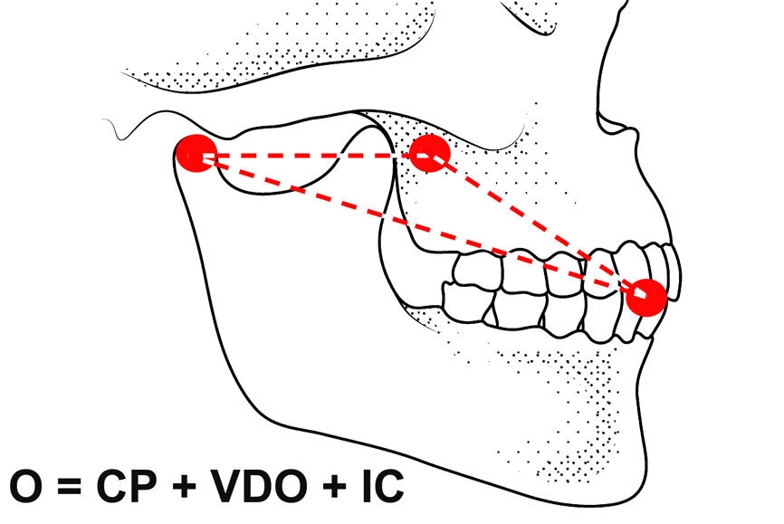 Fig. 5: Occlusion represented as mandibular position and intercuspation.