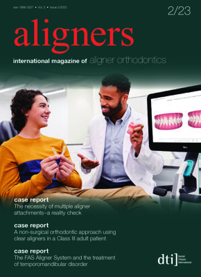 aligners international No. 2, 2023 aligners international No. 2, 2023