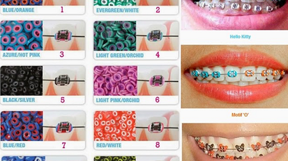 La irresistible moda de los brackets