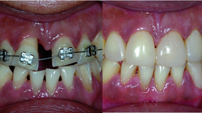MiCD: Do no harm cosmetic dentistry—Part I