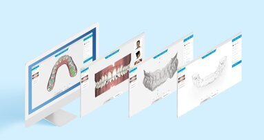 Henry Schein Krugg lancia il software Studio Pro 4.0 per gli allineatori trasparenti Reveal
