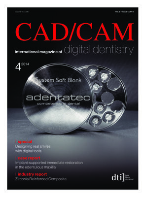 CAD/CAM international No. 4, 2014 CAD/CAM international No. 4, 2014