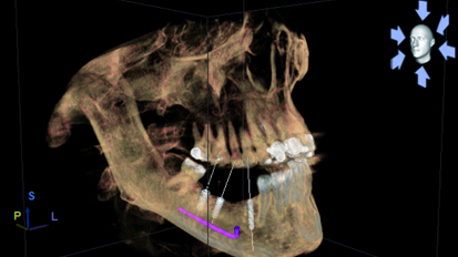 The 3-D difference: CBCT diagnostics to enhance treatment—Part 1