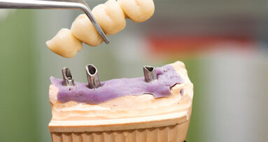 Neue Gütesiegel für zahntechnische Erzeugnisse