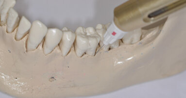 Drei Fragen zu schmerzfreier Zahnmedizin