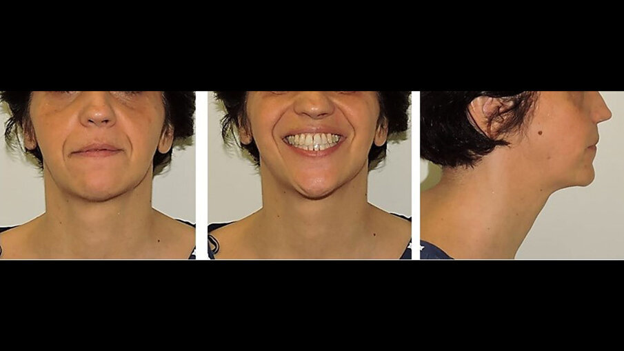 Fig. 10_Immagini extraorali che mostrano la simmetria delle strutture facciali.