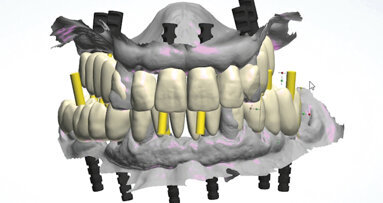Plně digitální Pro Arch protokol