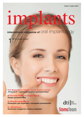 implants Czech Republic No. 1, 2019 implants Czech Republic No. 1, 2019