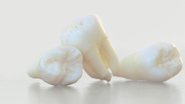 Armen verliezen acht tanden meer dan rijken