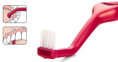 TePe Implant Care™ Il giusto strumento per una completa terapia implantare studiato su richiesta della professione dentale