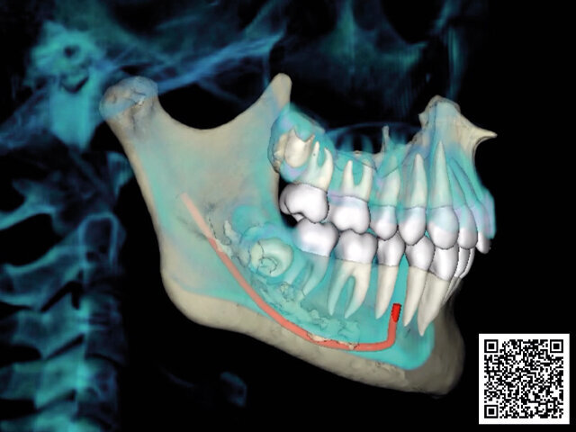 Video: Trojdimenzionální dynamická superimpozice změní naše chápání efektu léčby. Takováto validace postupů povede k významnému pokroku v oboru.